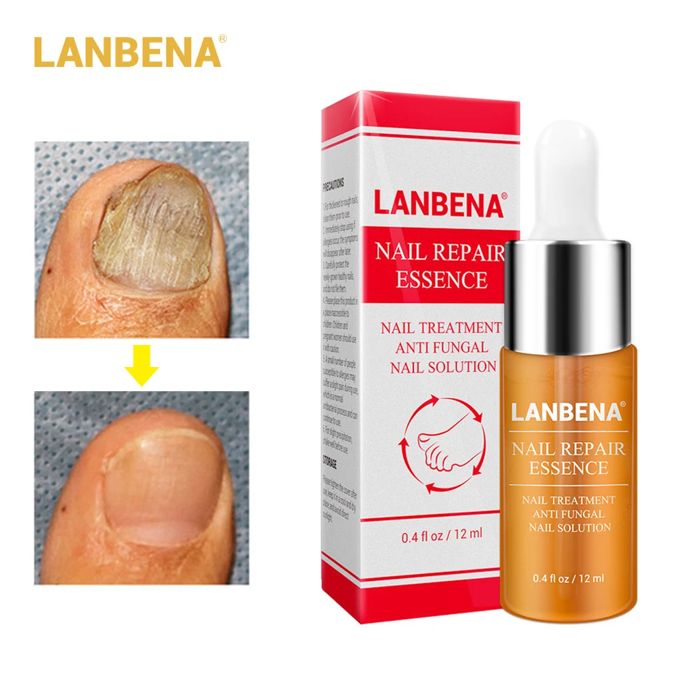 

LANBENA Onychomycosis Nail Repair Essence Serum Toe Nail Fungus Treatment Nourishment Oil Bright Hand Foot Care Nail Growth