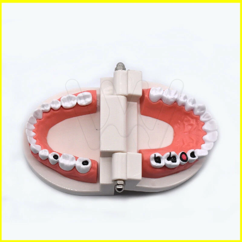 Dental-Study-Teaching-Teeth-Model-Caries-Tooth-Care-_57 (2)