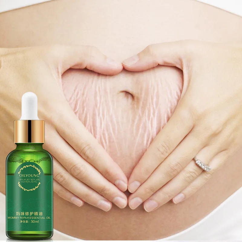 30 мл, женское Эфирное массажное масло, удаление растяжек, масло для беременных, Эфирное массажное масло