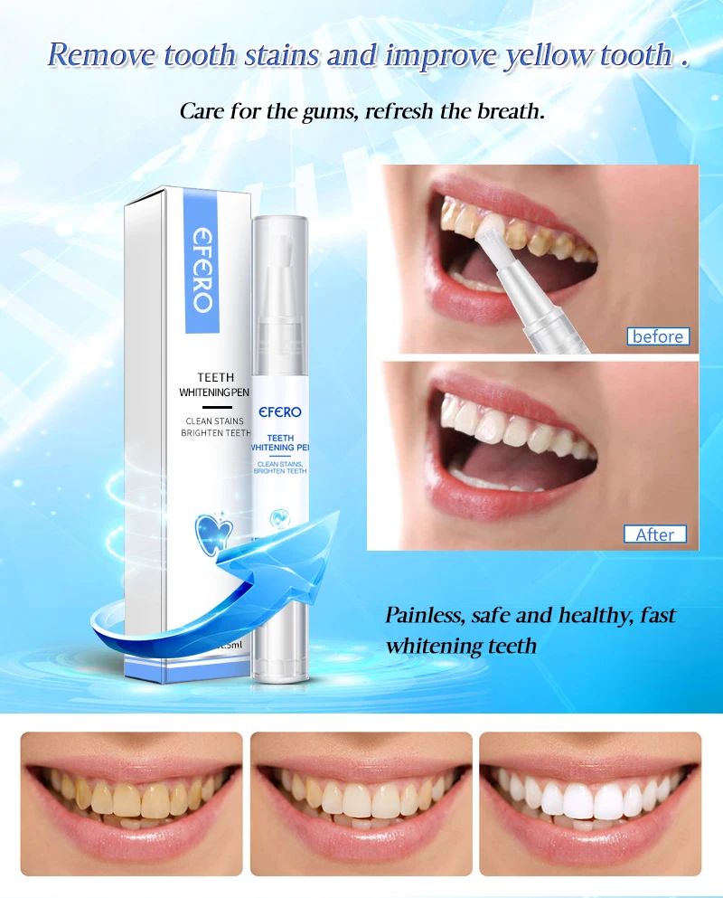 EFERO отбеливающая ручка для зубов кисть для зубов эссенция гигиена полости рта Очищающая сыворотка удаляет пятна налета отбеливание зубов