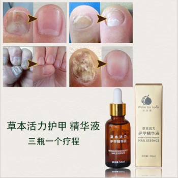 

1 pcs 30ml Nail and Foot Whitening Toenail Fungus Removal Foot Care Nail Gel Nail stickers