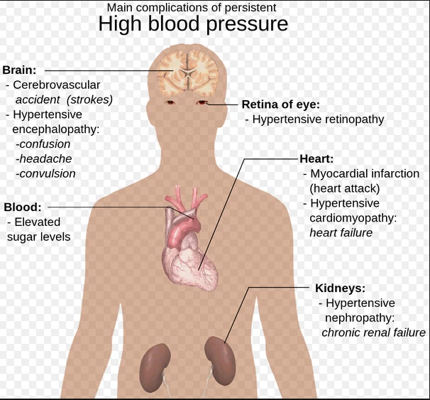naval patch for blood pressure
