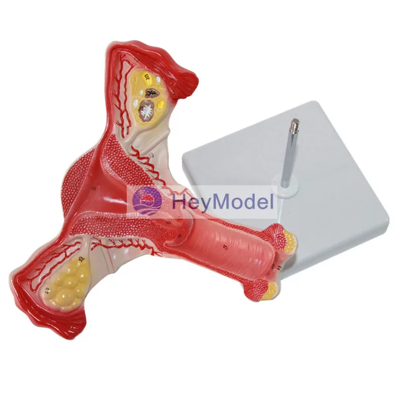 Женская модель матки HeyModel|uterus|uterus model |