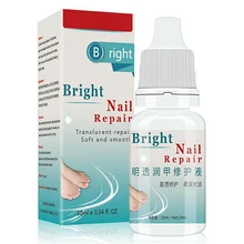 1 шт. 10 мл ремонт пальцев грибок для ногтей средство для удаления онихомикоза