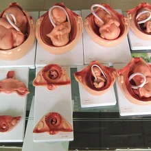 Плода гестационный процесс разработки модели, весь процесс эмбрионального модель развития, модель плода, эмбрион модели, 10/1 компл