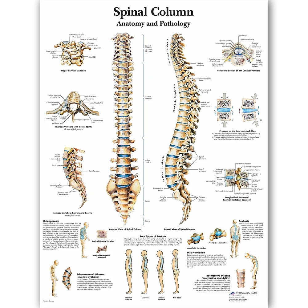 WANGART спинальная колонна Char плакат карта холст картина настенные картины для медицинского образования доктора офис класс домашний декор