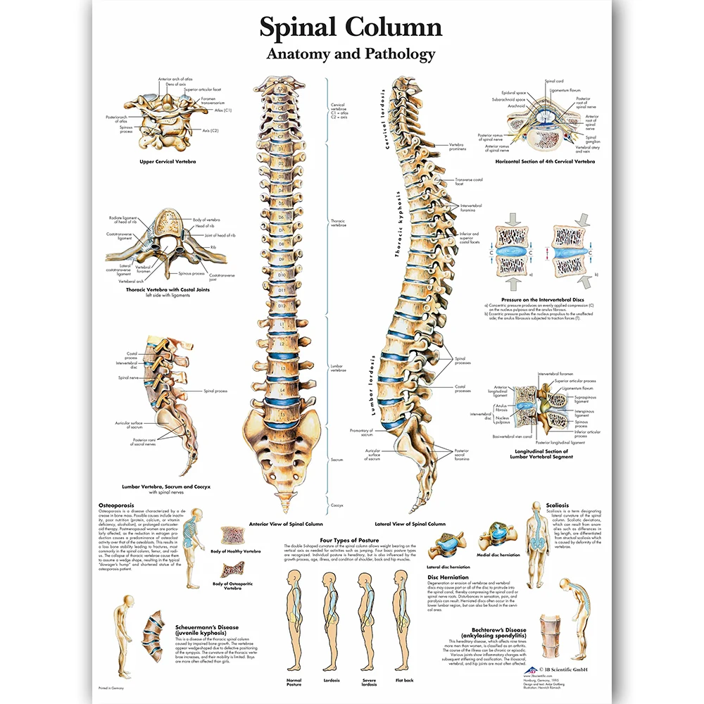Billig WANGART Spinal Spalte Char Poster Karte Leinwand Malerei Wand Bilder für Medizinische Bildung Ärzte Büro Klassenzimmer Wohnkultur