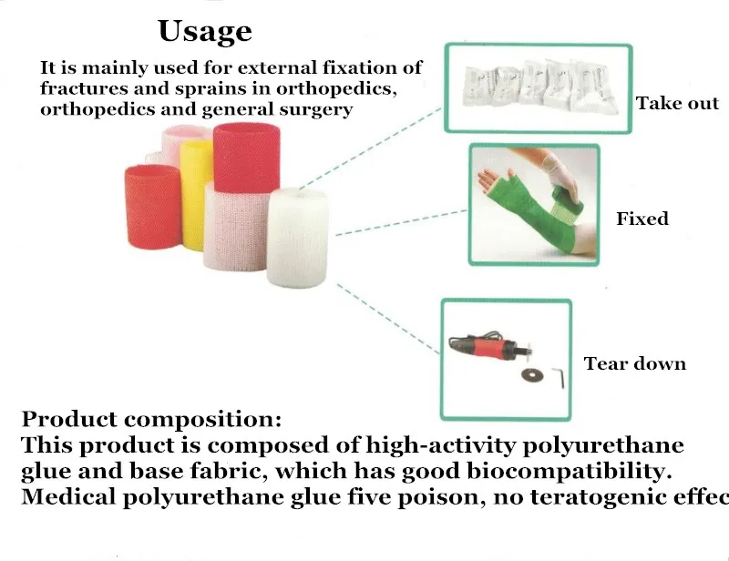 1 рулон ортопедической литой ленты высокий полимер фиксированный бинт полиуретановый материал замена поп-бинт для фиксации при переломах