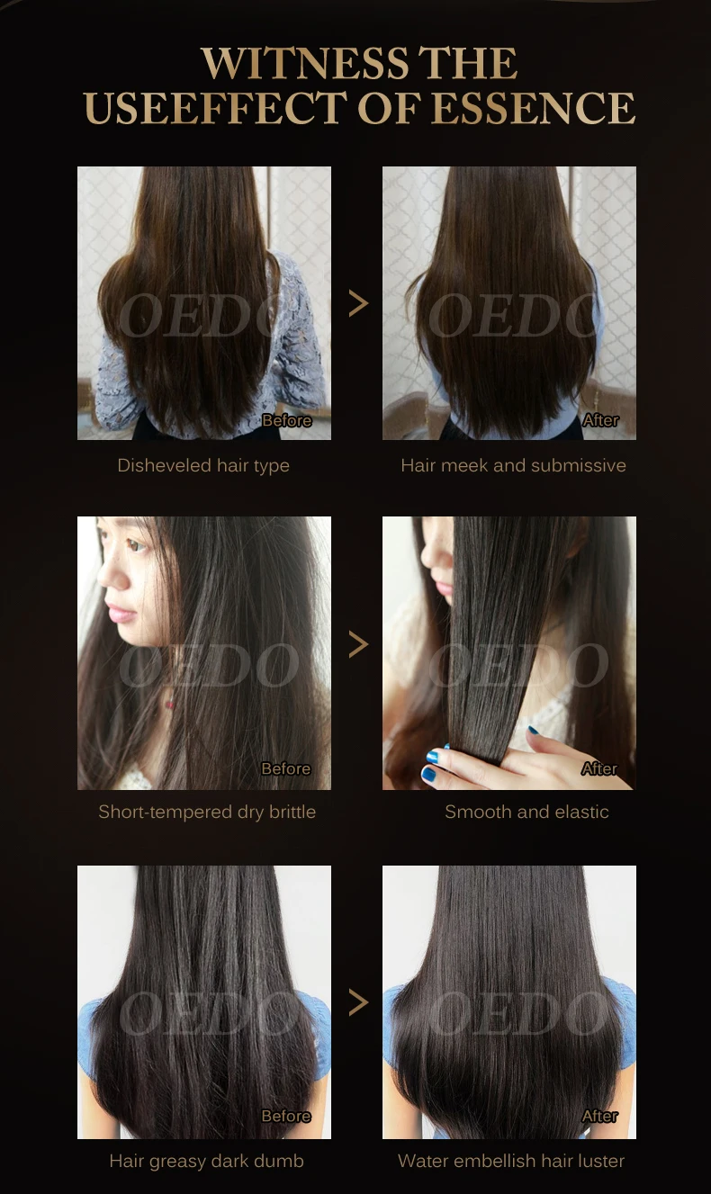 Набор для ухода за волосами марокканский Травяной Шампунь против перхоти быстрая мощная Сыворотка для роста волос восстанавливающая гладкие мягкие волосы