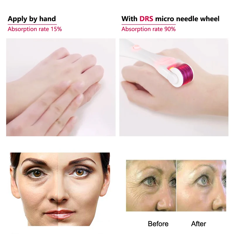 Goede Darsonval Led Elektrische Micro Naalden Derma Roller Titanium Mezoroller Microneedle Machine Voor Huidverzorging En Lichaam