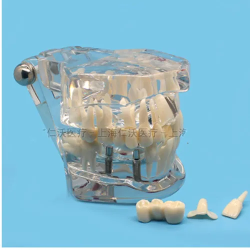 Различные стоматологические модели зубов используются для обучения и больничного стоматологического материала - Цвет: Цвет: желтый
