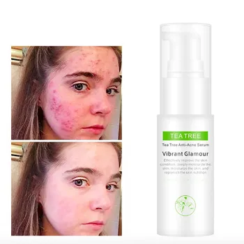 

New Tea Tree liquid Moisturizing Acne Treatment Face Serum Whitening Shrink Pores Skin Care Anti Aging Anti Wrinkle Cream