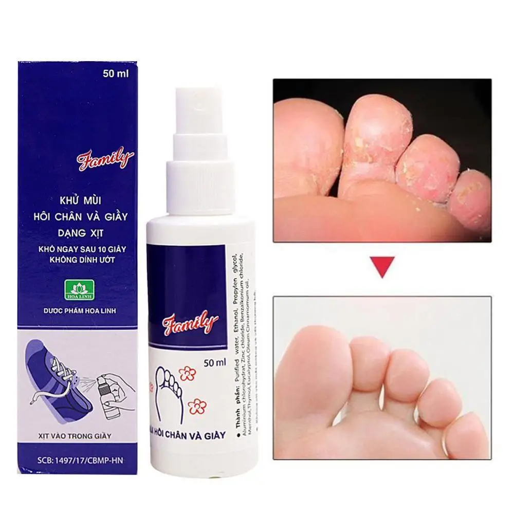 

Foot and Shoe Deodorant Odor Spray Deodorizer Eliminates Bad Odor Anti Bacterial Anti-fungal Foot Shoes Refresher Deodorant 50ML