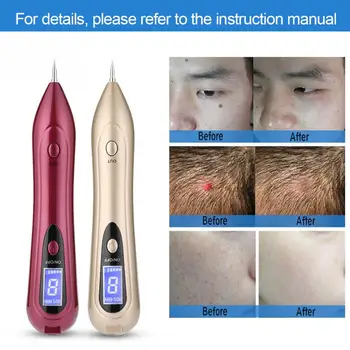 

LCD Screen Spot Removal Pen USB Freckle Spot Mole Tattoo Removal Pen Skin Repair Beauty Machine