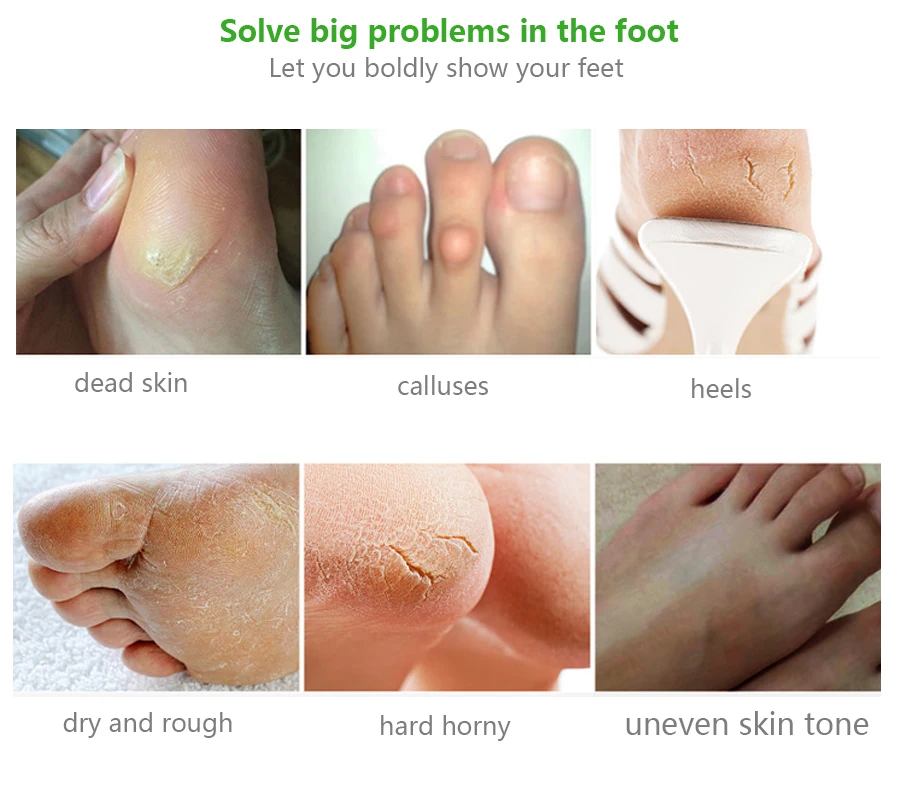 Exfoliating Foot Mask Aloe Foot Mask for Legs Moisturizing Mask Pedicure Socks Remove Dead Skin Heels Scrub Cuticles 4Pcs=2Pack Exfoliating Foot Mask Aloe Foot Mask for Legs Moisturizing Mask Pedicure Socks Remove Dead Skin Heels Scrub Cuticles 4Pcs=2Pack