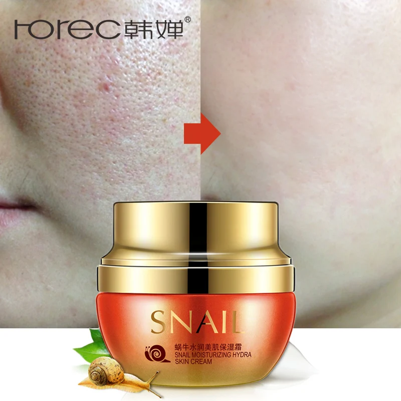 

ROREC Snail Face Cream Moisturizer Remover Freckles Collagen Cream Facial Treatment Acne Moisturizing Whitening Anti Wrinkle