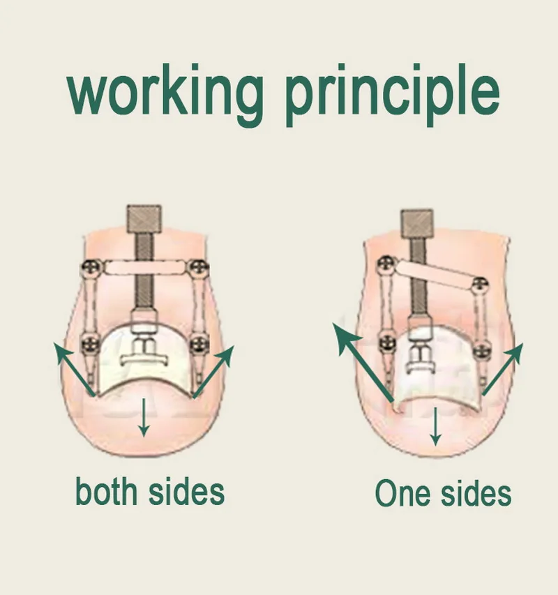 Медь 2 в 1 инструмент для коррекции вросших пальцев ног для 1 или 2 сторон для вросших ногтей, педикюра