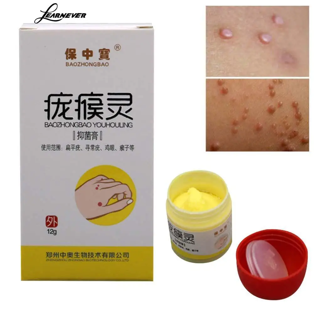 

Dropshipping Body Warts Treatment Cream Skin Tag Remover Foot Corn Removal Plantar Genital Warts Ointment Foot Care Cream 30g