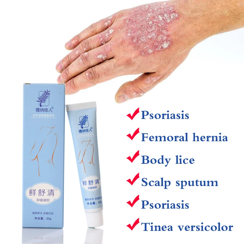 29A Natural Cream Works Really Well For Psoriasi Eczma Skin Care