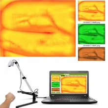 Новая версия Регулируемый монитор для просмотра Вены для взрослых и детей инфракрасные лампы USB камера Imaging IV медицинский прибор для поиска вены