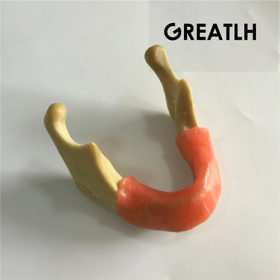 

Dental Implant Training Model Mandible With Soft Tissue for Implant Study
