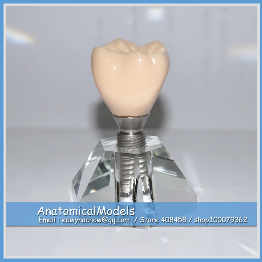 

13239 DH2019-1 Three Movable Parts Tooth Implant Demonstration Model, Medical Science Educational Dental Teaching Models