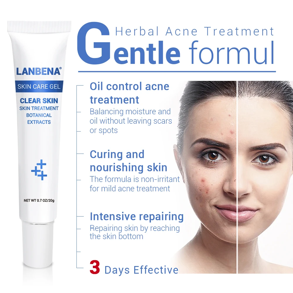 LANBENA Acne Treatment Gel Acne Cleaning Cream Blackhead Remover Acne Spots Face Acne Scars Skin Care 1 LANBENA Acne Treatment Gel Acne Cleaning Cream Blackhead Remover Acne Spots Face Acne Scars Skin Care 2