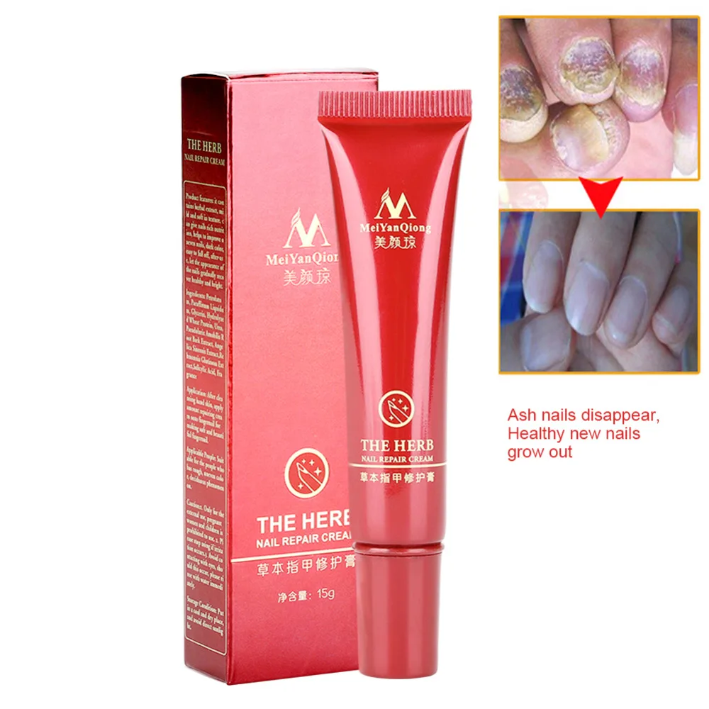 китайский крем от грибка. Clarins hand and nail treatment cream. Clarins hand and nail treatment cream 100. Nail treatment cream. крем от грибков на ногтях.