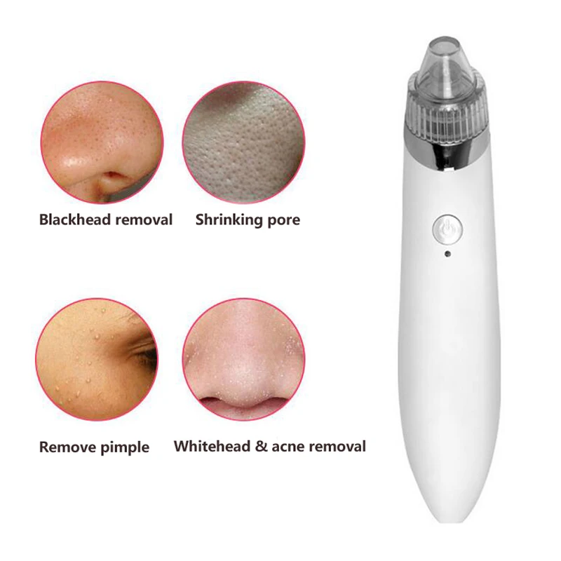 blackhead vacuum