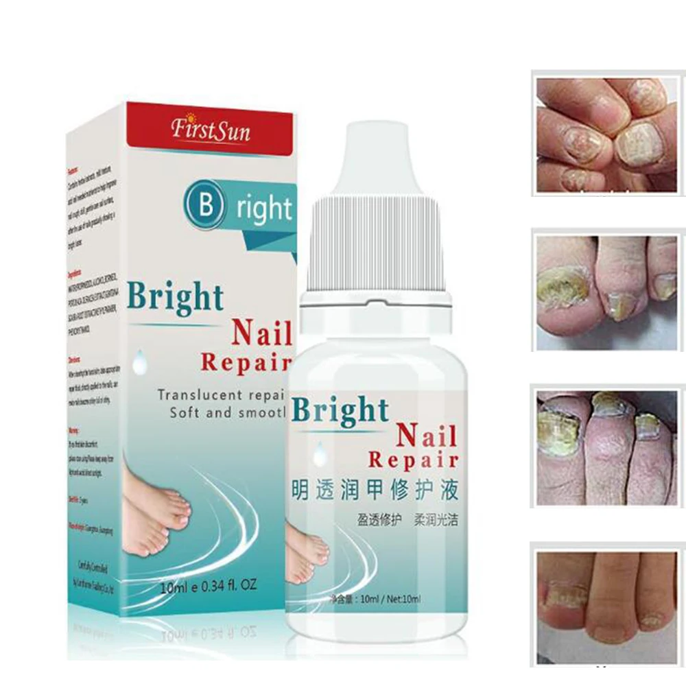 

Chinese Toe Nail Fungus Treatment Anti Fungal Nail Infection Removal Nail Foot Protector Skin Care Cream Massage Plaster D014