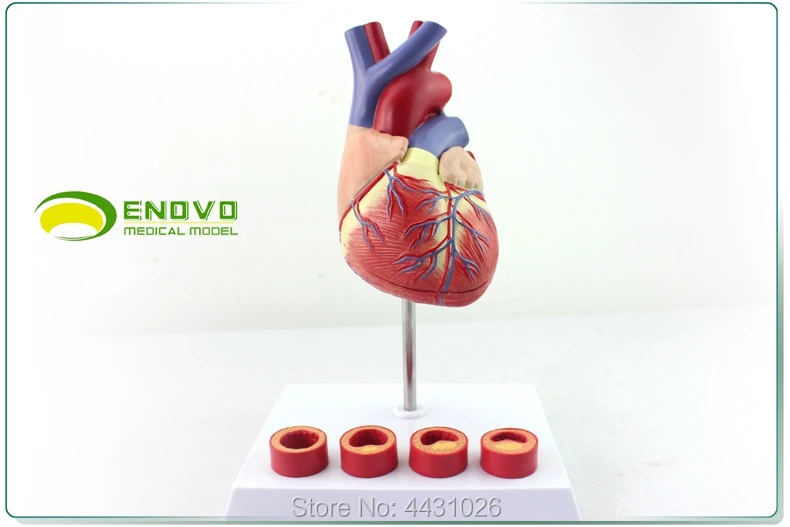 ENOVO 1-1 Медицинские модель человеческого сердца ишемической тромбоз кардиологии преподавания атеросклероз