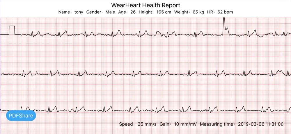 Zeblaze VIBE 3 ECG Смарт-часы с пульсометром, Мгновенным ECG по требованию, цветной дисплей, умные часы, монитор сна, Android iOS