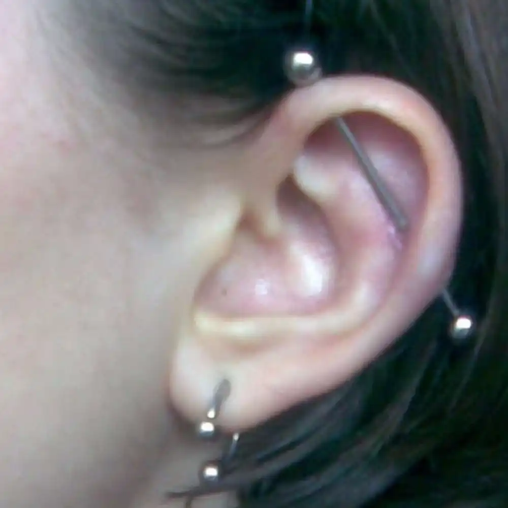 bar cartilage