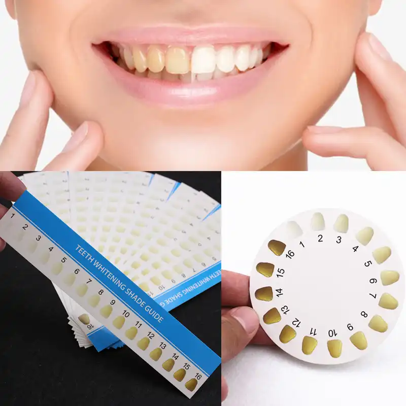 Detail Feedback Questions About 30pcs 16 Colors Teeth Whitening Detail Feedback Questions About 30pcs 16 Colors Teeth Whitening Shade Guide Paper Chart Card For Tooth Whiter Effective Compare Professional Dental Supplies