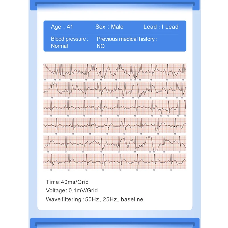  KAIHAI ECG PPG smart band bracelet electrocardiograph heart rate monitor blood pressure Heart rate  - 33049156906