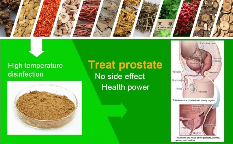 Prostatitis 22- ben
