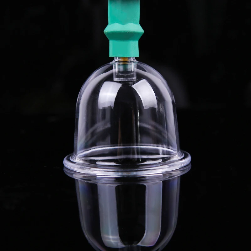 cupping (4)