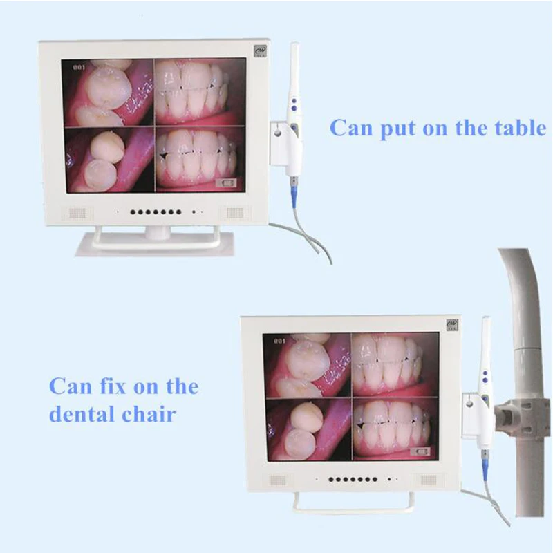 Зубные Интраоральной Камера m-978(2 в 1)+ Автономное 17 дюймов светодиодный Мониторы полости рта Камера