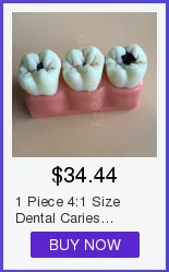 6 шт./упак. стоматологический верхняя Overdenture превосходное 4 импланты с шероховатой поверхностью демонстрационные модели 6001 02 модель зубов