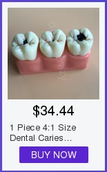 Dental dos Dentes da Doença do Implante com Ponte da Restauração Dentista do Dente para o Ensino de Alta Modelo Qualidade 7 dente para o ensino de alta qualidade