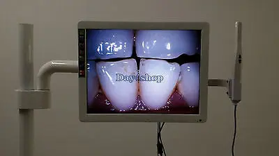 

Dental 8-LED Intraoral Camera with 17" LCD Monitor and Dental Mount Holder Dentist Clinc Computer