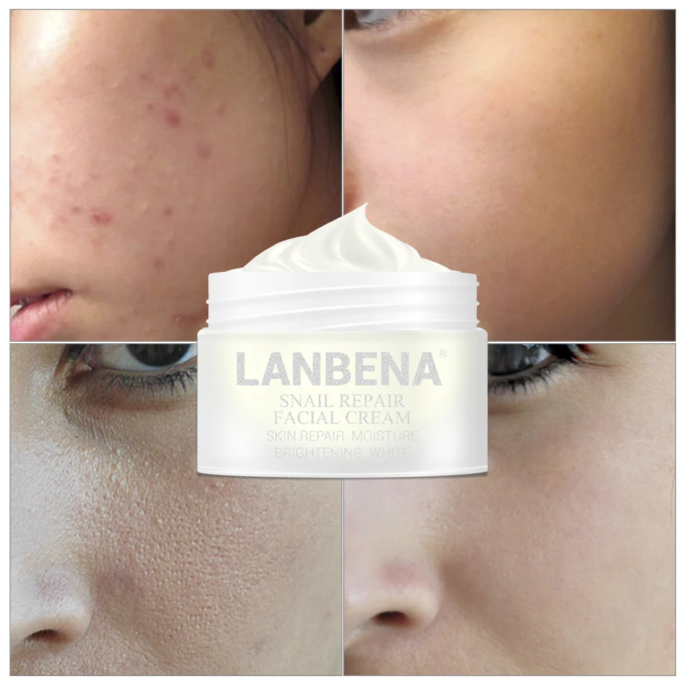 

Lanbena repair cream snail cream Moisturizing facial cream Acne treatment Day cream Firming skin care Anti wrinkles Anti-aging
