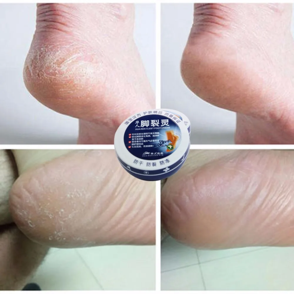 Косметика против сухих трещин ремонт пятки уход за ногами Бальзам крем Отшелушивающий лечение