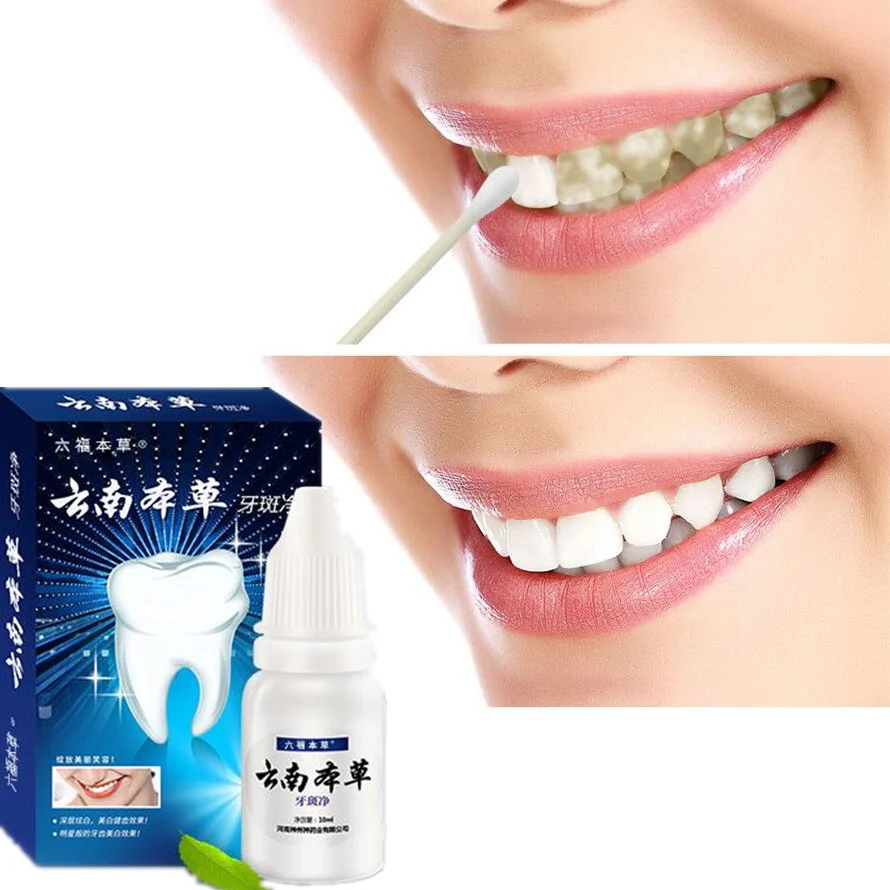 5 шт., отбеливатель для белых зубов, жидкость для чистки зубов, 3D эссенция, стоматологический отбеливатель, гигиена полости рта, сыворотка для удаления налета, пятен