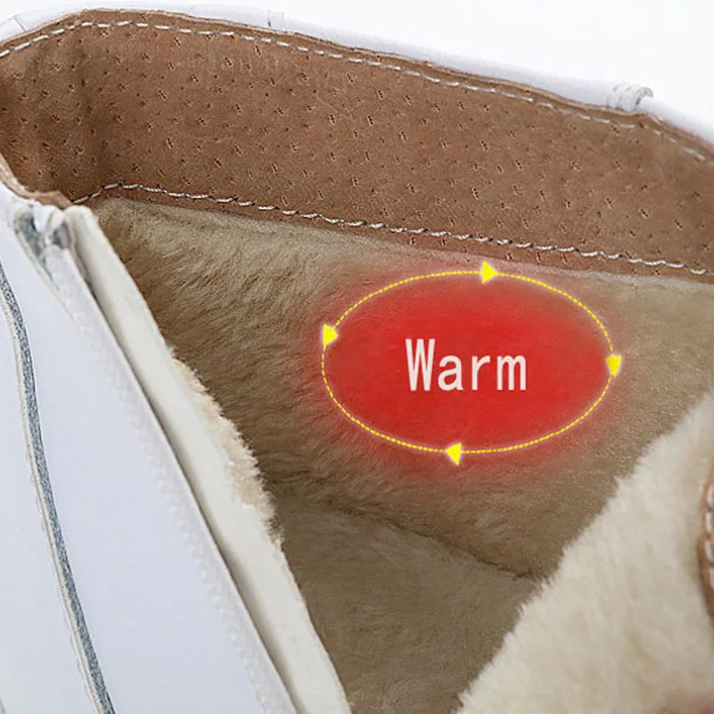YAERNI Fashion Genuine Leather Women Boots Round Toe Fur Ankle Snow Boots Side Zipper White Warm Female Women Nurse Shoes
