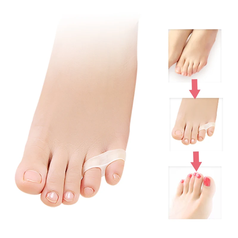 1 пара корректор вальгусной деформации большого пальца ноги|bunion toe separator|hallux