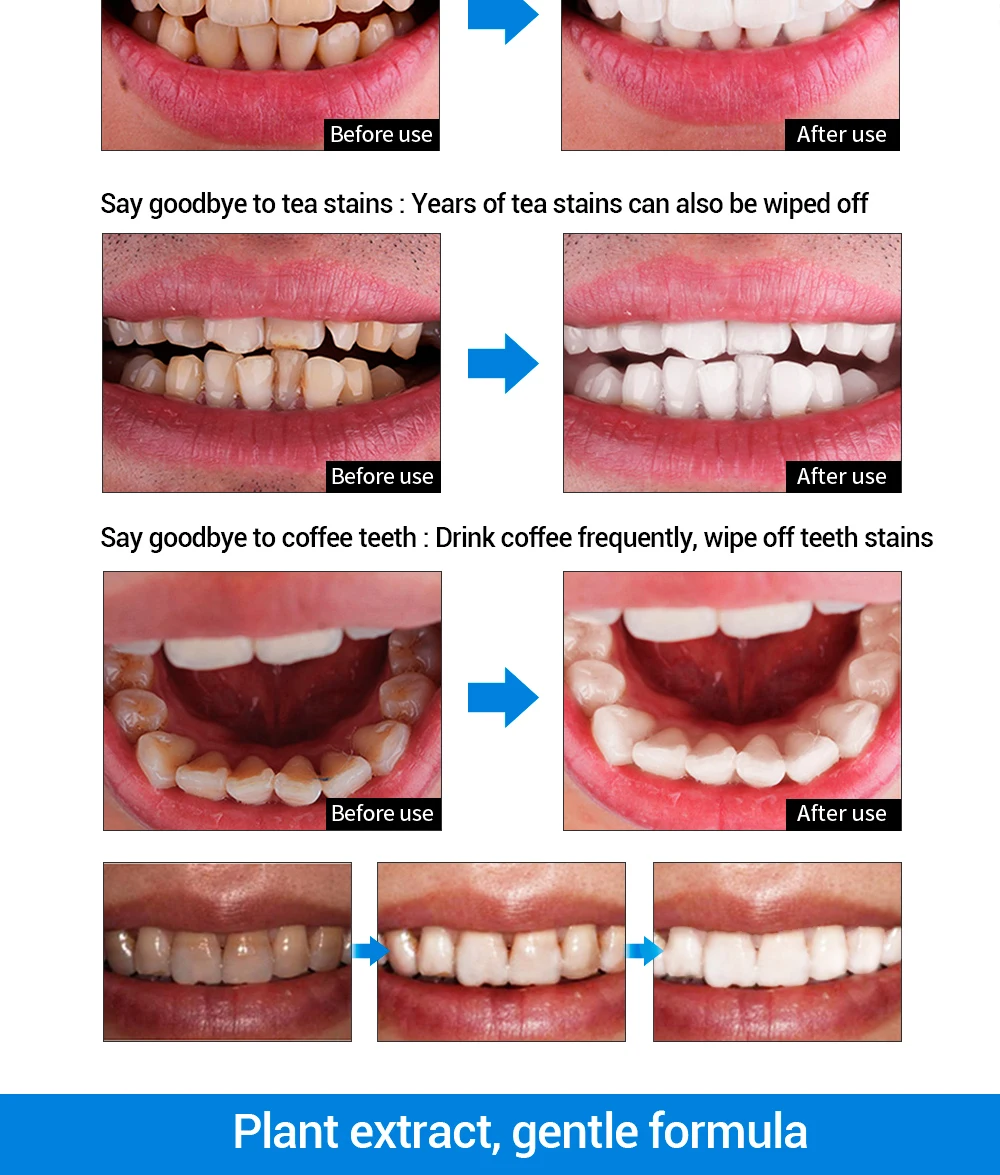 LANBENA отбеливание зубов пудра с эссенцией гигиена полости рта Чистящая сыворотка удаляет зубной налет пятна Отбеливание зубов стоматологические инструменты зубная паста