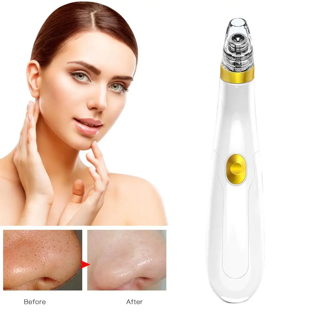 

New Electric Blackhead Remover Device Facial Pore Cleansing Acne Blackhead Remover Comedone Extractor Beauty Skin Care Machine