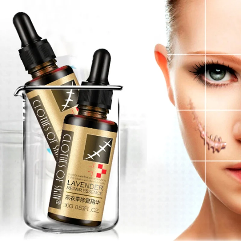 

30g Useful Scar Repair Skin Essential Oil Lavender Essence Skin Care Natural Pure Remove Ance Burn Strentch Marks Scar Removal