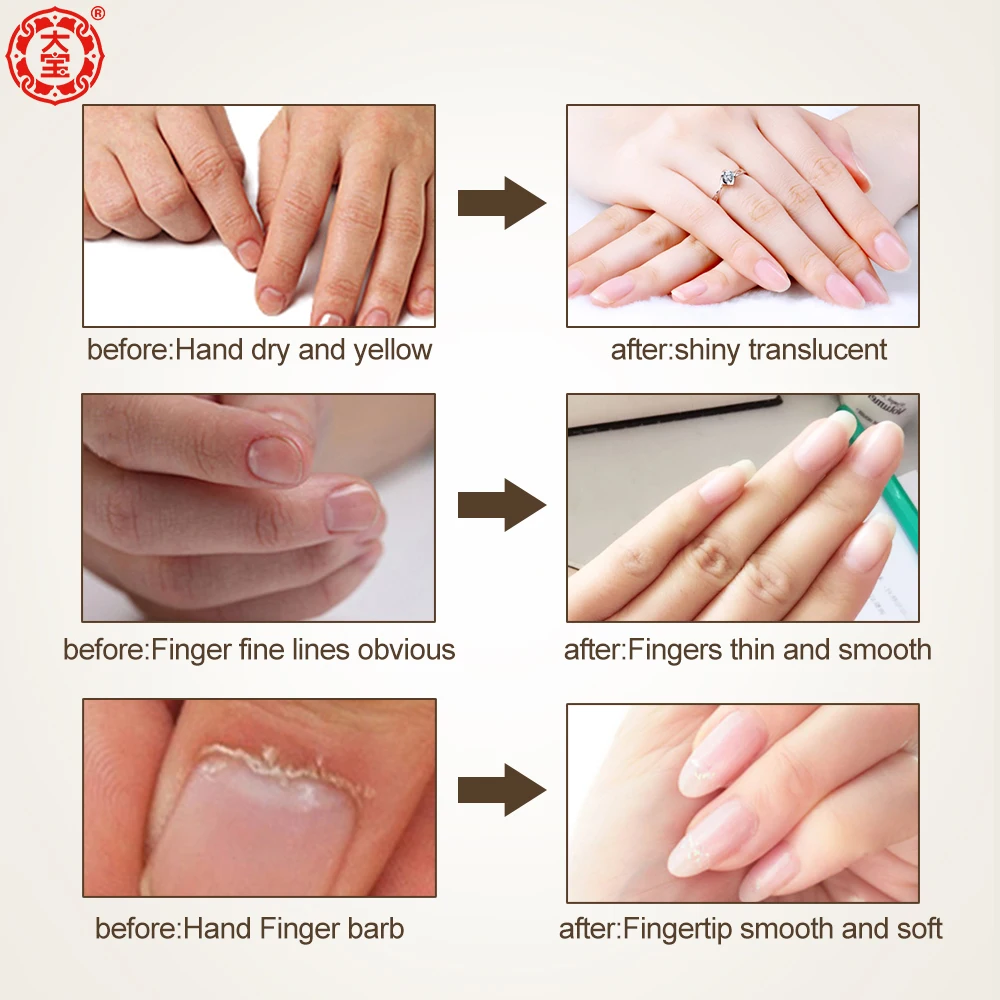finger fix cream